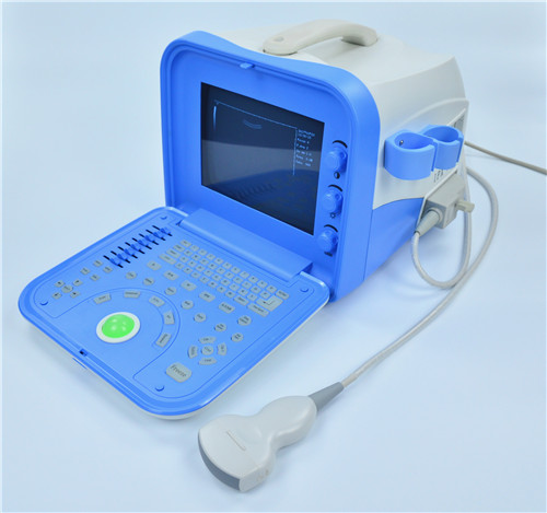 Digital Portable Ultrasonic  Diagnosis Equipment