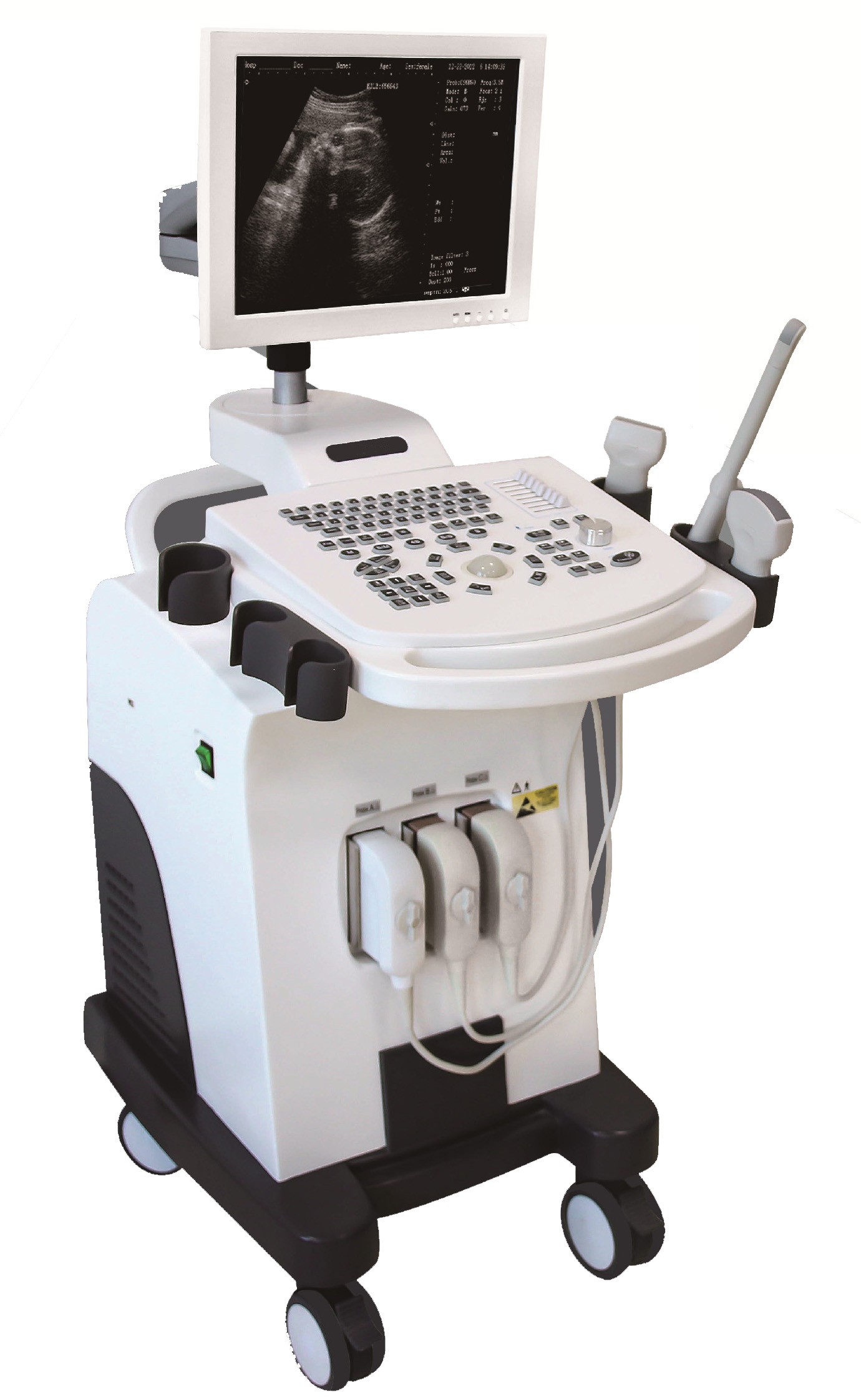 Full-digital Trolley Ultrasound Machine