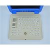 Digital Laptop Ultrasonic  Diagnosis  Equipment