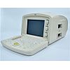 Digital Portable Ultrasonic  Diagnosis Equipment 