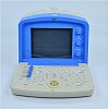 Digital Portable Ultrasonic  Diagnosis Equipment 