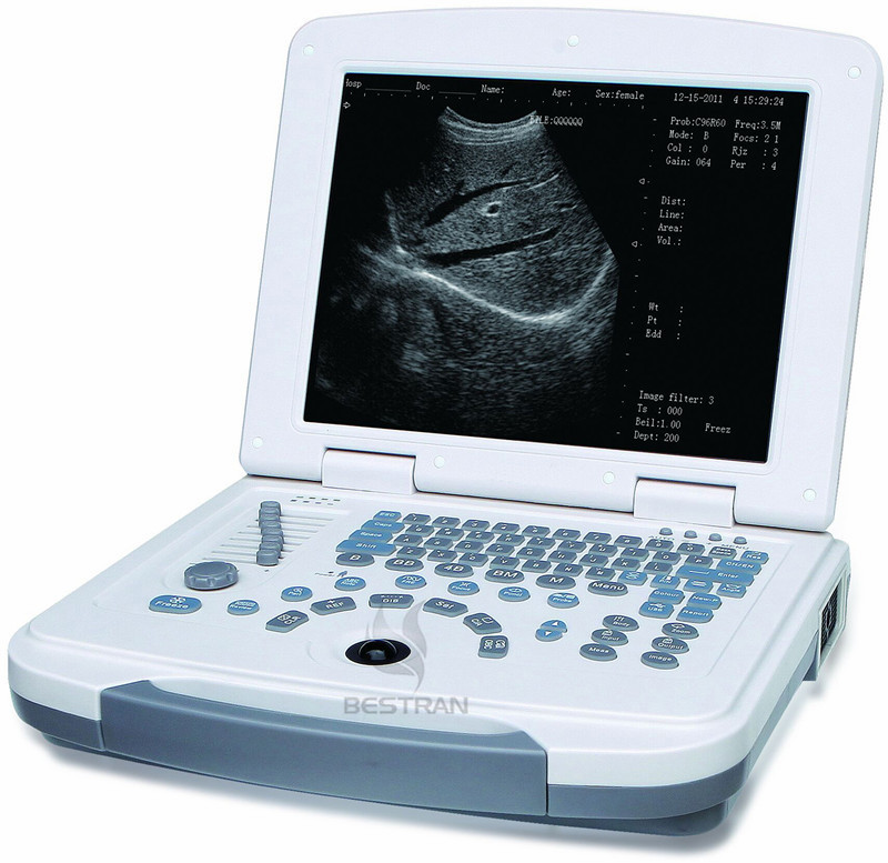 Full-digital laptop Ultrasound Diagnostic System