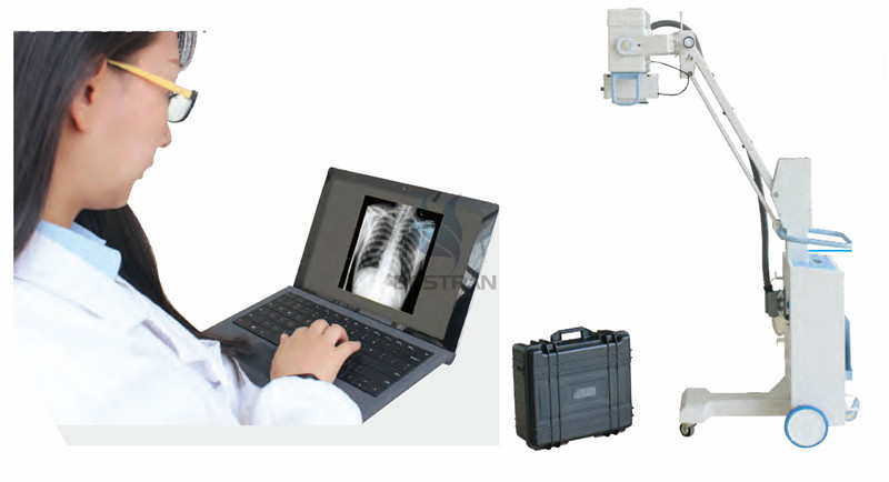 Digital Mobile X-ray System