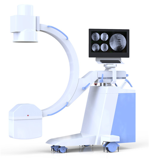 High frequency Mobile digital C-arm