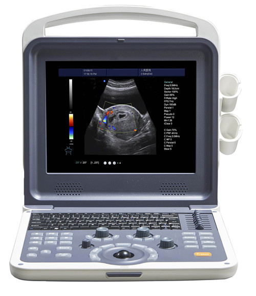 4D Portable color doppler machine