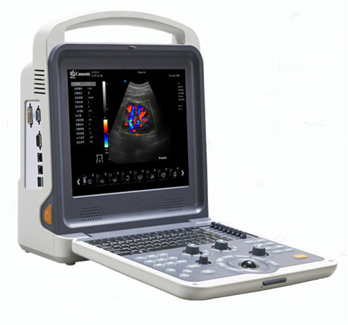 4D Portable color doppler machine