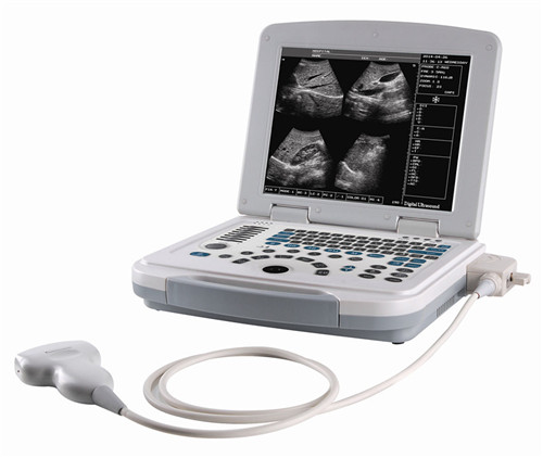 B/W laptop ultrasound machine 