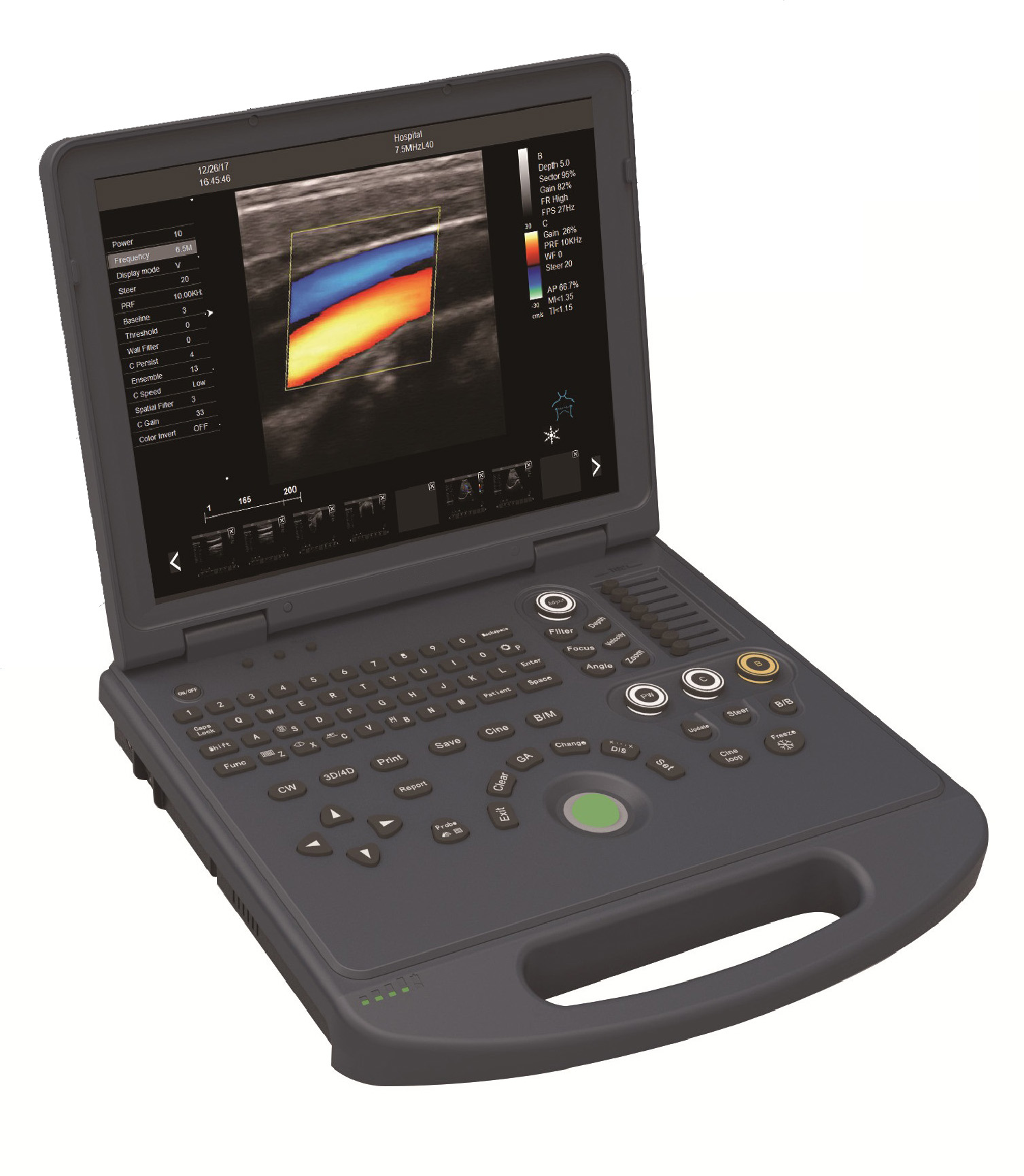 Laptop color doppler Ultrasound Diagnostic System
