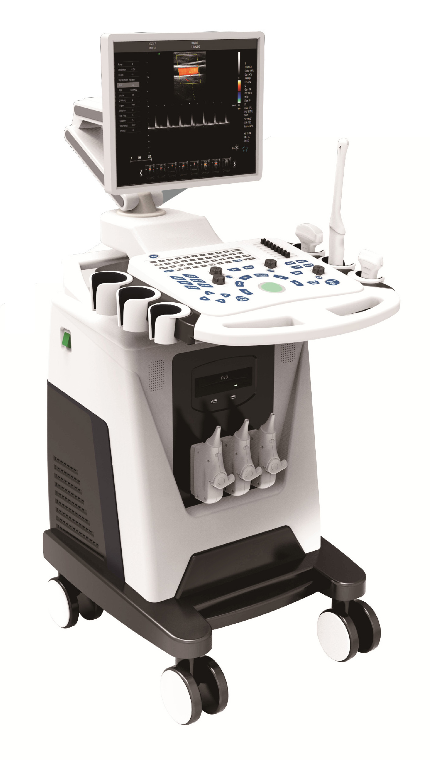 Color Ultrasound Diagnostic System
