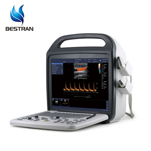 Full Digital Color Doppler Ultrasound Scanner Machine 