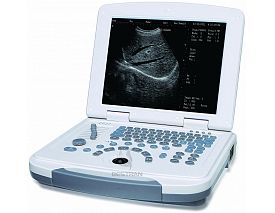 Laptop Ultrasound Scanner