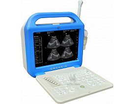 Digital Laptop Ultrasonic  Diagnosis  Equipment