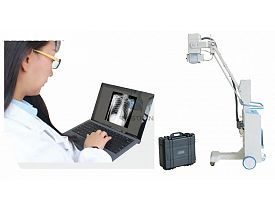 Digital Mobile X-ray System