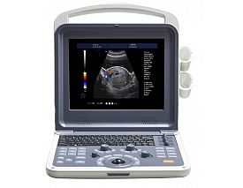 4D Portable color doppler machine