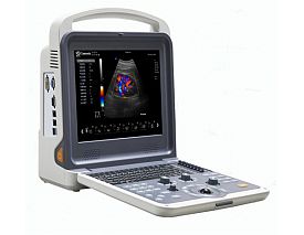 4D Portable color doppler machine