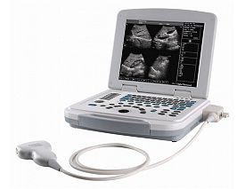 B/W laptop ultrasound machine 