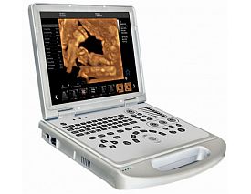 4D laptop color doppler ultrasound system