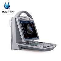 Full Digital Color Doppler Ultrasound scanner（Human)