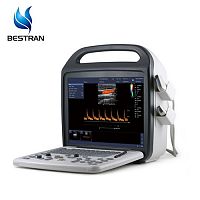 Full Digital Color Doppler Ultrasound Scanner Machine 