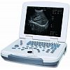 Full-digital laptop Ultrasound Diagnostic System