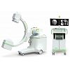 High Frequency Mobile X-ray C-arm System