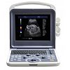 4D Portable color doppler machine