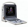 4D Portable color doppler machine