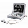 B/W laptop ultrasound machine 