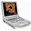 2D/3D  Laptop Ultrasound Scanner