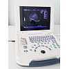 B/W laptop ultrasound machine 