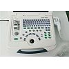 B/W laptop ultrasound machine 