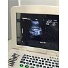 Laptop Ultrasound Scanner