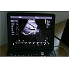 Laptop color doppler Ultrasound Diagnostic System