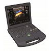 Laptop color doppler Ultrasound Diagnostic System