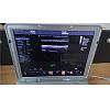 Laptop color doppler Ultrasound Diagnostic System