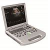 4D laptop color doppler ultrasound system