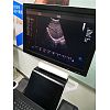 4D Trolley Ultrasound Machine