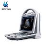 Full Digital Color Doppler Ultrasound scanner（Human)