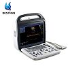 Full Digital Color Doppler Ultrasound Scanner Machine 