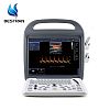 Full Digital Color Doppler Ultrasound Scanner Machine 